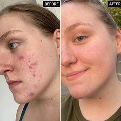 The Ordinary Glycolic Acid 7% Toning Solution in Pakistan - Buy Vitamins