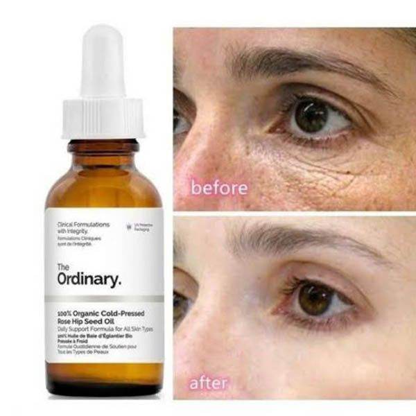 The Ordinary 100% Organic Cold-Pressed Rose Hip Seed Oil - Buy Vitamins